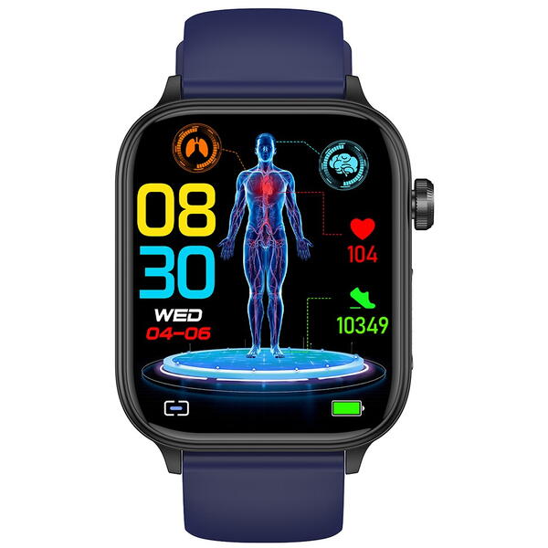 SmartWatch cu Apel Bluetooth, Glucometru, Analiza Impedantei Bioelectrice, EKG, HRV, Temperatura Corporala, Ritm Cardiac, Nivel Oxigen, Tensiune Arteriala S887