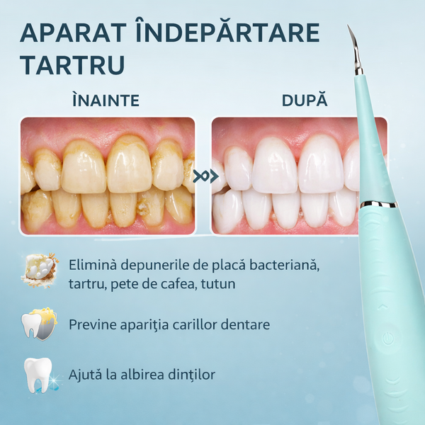 Dispozitiv electric pentru indepartarea depunerilor de tartru, Turcoaz