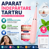 Dispozitiv electric pentru indepartarea depunerilor de tartru, Roz